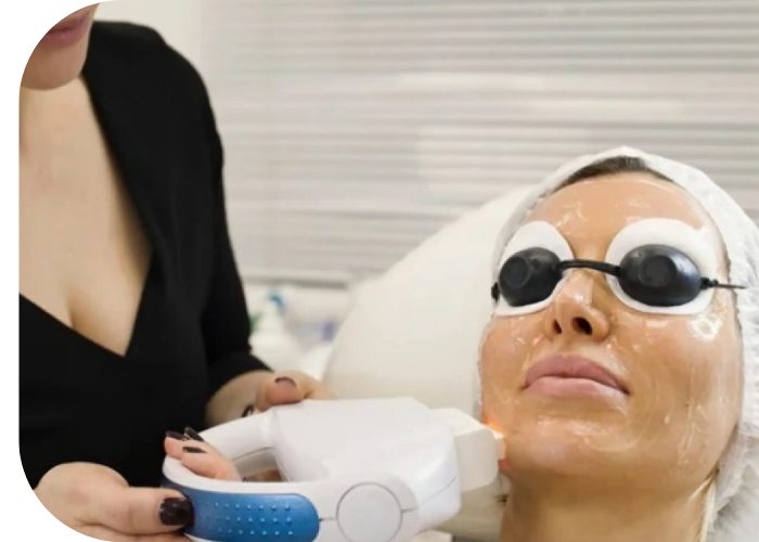 BBL broadband light therapy treatments