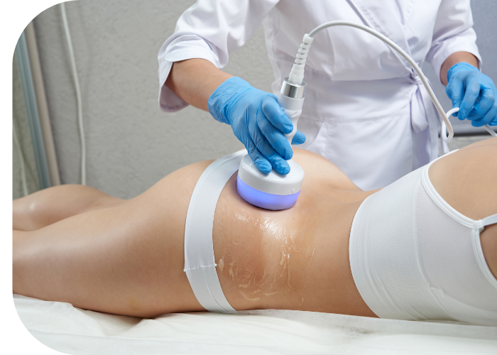 CoolSculpting (2) cool sculpting near me