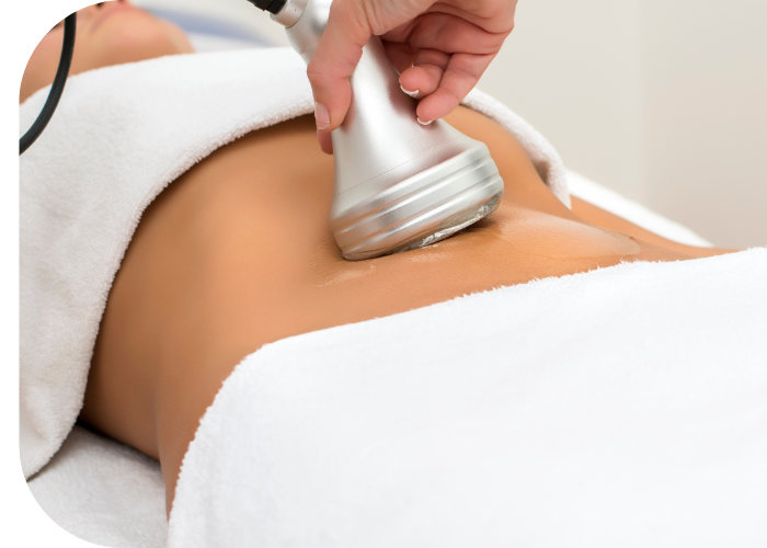 cool sculpting treatments