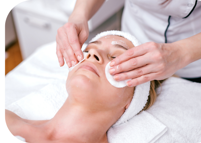 chemical peel facials