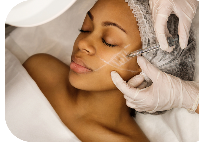 Filler facial filler near me